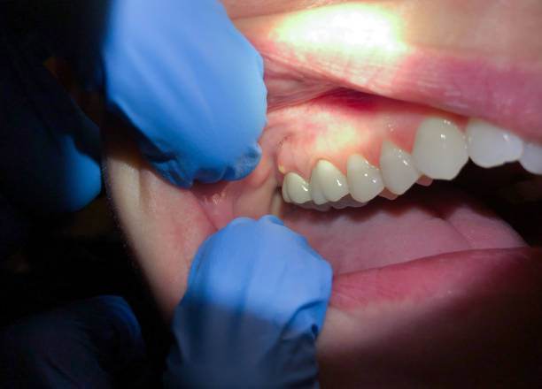 Best Emergency Cosmetic Dentistry in Almont, MI