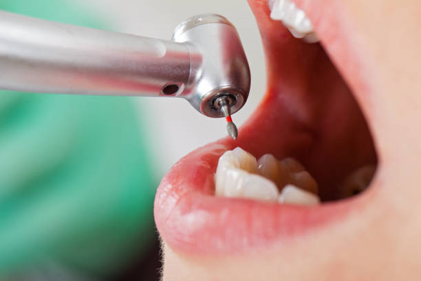 Best Urgent Dental Care for Toothache in Almont, MI